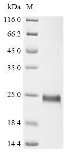 (Tris-Glycine gel) Discontinuous SDS-PAGE (reduced) with 5% enrichment gel and 15% separation gel. (Tris-Glycine gel) Discontinuous SDS-PAGE (reduced) with 5% enrichment gel and 15% separation gel.