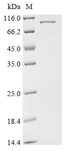 Recombinant Penaeus monodon Hemocyanin (HcVn) - image 1