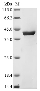 Recombinant Escherichia coli O45:K1 Aspartate carbamoyltransferase (pyrB) - image 1