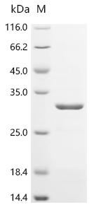 Recombinant Human Immunoglobulin lambda-like polypeptide 5 (IGLL5) - image 1