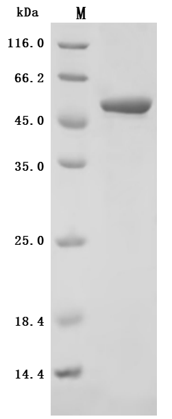 (Tris-Glycine gel) Discontinuous SDS-PAGE (reduced) with 5% enrichment gel and 15% separation gel.