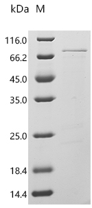 Recombinant Agaricus bisporus Polyphenol oxidase 3 (PPO3) - image 1