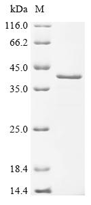 Recombinant Neisseria meningitidis FrpA/C-binding lipoprotein (frpD_3) - image 1
