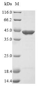 (Tris-Glycine gel) Discontinuous SDS-PAGE (reduced) with 5% enrichment gel and 15% separation gel. (Tris-Glycine gel) Discontinuous SDS-PAGE (reduced) with 5% enrichment gel and 15% separation gel.