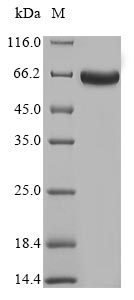 SDS-PAGE- Recombinant protein Mycobacterium mtr