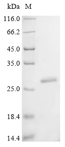 Recombinant Human Lysine-specific demethylase 6B (KDM6B) , partial - image 1