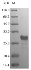 SDS-PAGE- Recombinant protein Bacillus luxS