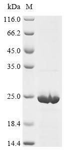 Recombinant Mouse Gamma-synuclein (Sncg) - image 1
