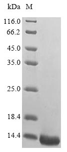 (Tris-Glycine gel) Discontinuous SDS-PAGE (reduced) with 5% enrichment gel and 15% separation gel. (Tris-Glycine gel) Discontinuous SDS-PAGE (reduced) with 5% enrichment gel and 15% separation gel.