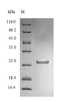 SDS-PAGE- Recombinant protein Mycobacterium relG