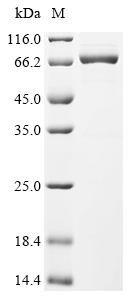 (Tris-Glycine gel) Discontinuous SDS-PAGE (reduced) with 5% enrichment gel and 15% separation gel. (Tris-Glycine gel) Discontinuous SDS-PAGE (reduced) with 5% enrichment gel and 15% separation gel.