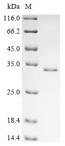 (Tris-Glycine gel) Discontinuous SDS-PAGE (reduced) with 5% enrichment gel and 15% separation gel. (Tris-Glycine gel) Discontinuous SDS-PAGE (reduced) with 5% enrichment gel and 15% separation gel.