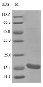(Tris-Glycine gel) Discontinuous SDS-PAGE (reduced) with 5% enrichment gel and 15% separation gel. (Tris-Glycine gel) Discontinuous SDS-PAGE (reduced) with 5% enrichment gel and 15% separation gel.