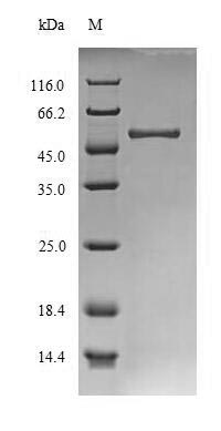 (Tris-Glycine gel) Discontinuous SDS-PAGE (reduced) with 5% enrichment gel and 15% separation gel. (Tris-Glycine gel) Discontinuous SDS-PAGE (reduced) with 5% enrichment gel and 15% separation gel.