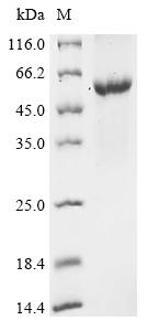 (Tris-Glycine gel) Discontinuous SDS-PAGE (reduced) with 5% enrichment gel and 15% separation gel. (Tris-Glycine gel) Discontinuous SDS-PAGE (reduced) with 5% enrichment gel and 15% separation gel.