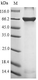 (Tris-Glycine gel) Discontinuous SDS-PAGE (reduced) with 5% enrichment gel and 15% separation gel. (Tris-Glycine gel) Discontinuous SDS-PAGE (reduced) with 5% enrichment gel and 15% separation gel.