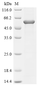 Recombinant Rabies virus Glycoprotein G (G) , partial - image 1
