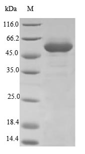 (Tris-Glycine gel) Discontinuous SDS-PAGE (reduced) with 5% enrichment gel and 15% separation gel. (Tris-Glycine gel) Discontinuous SDS-PAGE (reduced) with 5% enrichment gel and 15% separation gel.