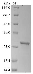 Recombinant Mycobacterium tuberculosis Trehalose monomycolate exporter MmpL3 (mmpL3) , partial - image 1