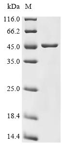 (Tris-Glycine gel) Discontinuous SDS-PAGE (reduced) with 5% enrichment gel and 15% separation gel.