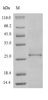 (Tris-Glycine gel) Discontinuous SDS-PAGE (reduced) with 5% enrichment gel and 15% separation gel. (Tris-Glycine gel) Discontinuous SDS-PAGE (reduced) with 5% enrichment gel and 15% separation gel.