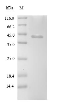 (Tris-Glycine gel) Discontinuous SDS-PAGE (reduced) with 5% enrichment gel and 15% separation gel. (Tris-Glycine gel) Discontinuous SDS-PAGE (reduced) with 5% enrichment gel and 15% separation gel.