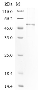 (Tris-Glycine gel) Discontinuous SDS-PAGE (reduced) with 5% enrichment gel and 15% separation gel. (Tris-Glycine gel) Discontinuous SDS-PAGE (reduced) with 5% enrichment gel and 15% separation gel.