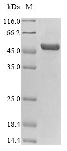 (Tris-Glycine gel) Discontinuous SDS-PAGE (reduced) with 5% enrichment gel and 15% separation gel. (Tris-Glycine gel) Discontinuous SDS-PAGE (reduced) with 5% enrichment gel and 15% separation gel.