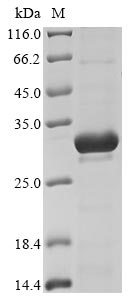(Tris-Glycine gel) Discontinuous SDS-PAGE (reduced) with 5% enrichment gel and 15% separation gel. (Tris-Glycine gel) Discontinuous SDS-PAGE (reduced) with 5% enrichment gel and 15% separation gel.
