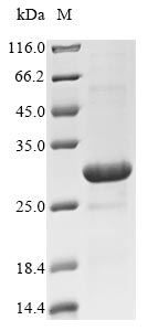 (Tris-Glycine gel) Discontinuous SDS-PAGE (reduced) with 5% enrichment gel and 15% separation gel. (Tris-Glycine gel) Discontinuous SDS-PAGE (reduced) with 5% enrichment gel and 15% separation gel.
