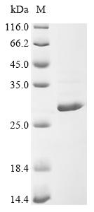 Recombinant Lupinus angustifolius Conglutin beta, partial - image 1