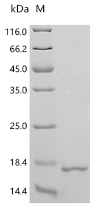 Recombinant Porcine reproductive and respiratory syndrome virus GP5, partial - image 1
