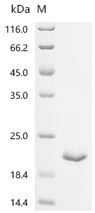 Recombinant Porcine reproductive and respiratory syndrome virus GP5, partial - image 1