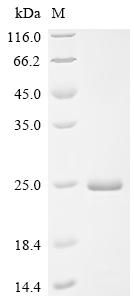 Recombinant Porcine reproductive and respiratory syndrome virus Nucleoprotein (N) - image 1