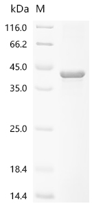 (Tris-Glycine gel) Discontinuous SDS-PAGE (reduced) with 5% enrichment gel and 15% separation gel.