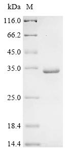 (Tris-Glycine gel) Discontinuous SDS-PAGE (reduced) with 5% enrichment gel and 15% separation gel.