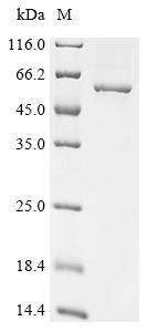 Recombinant Human T-complex protein 11-like X-linked protein 2 (TCP11X2) - image 1
