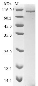 (Tris-Glycine gel) Discontinuous SDS-PAGE (reduced) with 5% enrichment gel and 15% separation gel. (Tris-Glycine gel) Discontinuous SDS-PAGE (reduced) with 5% enrichment gel and 15% separation gel.