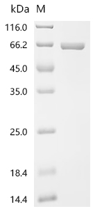 Recombinant Ustilaginoidea virens Phosphoacetylglucosamine mutase - image 1