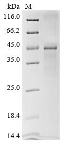 (Tris-Glycine gel) Discontinuous SDS-PAGE (reduced) with 5% enrichment gel and 15% separation gel. (Tris-Glycine gel) Discontinuous SDS-PAGE (reduced) with 5% enrichment gel and 15% separation gel.