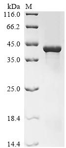 (Tris-Glycine gel) Discontinuous SDS-PAGE (reduced) with 5% enrichment gel and 15% separation gel. (Tris-Glycine gel) Discontinuous SDS-PAGE (reduced) with 5% enrichment gel and 15% separation gel.