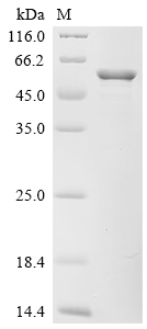 Recombinant Proteus mirabilis Serralysin (zapA) - image 1
