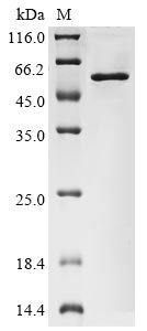 (Tris-Glycine gel) Discontinuous SDS-PAGE (reduced) with 5% enrichment gel and 15% separation gel. (Tris-Glycine gel) Discontinuous SDS-PAGE (reduced) with 5% enrichment gel and 15% separation gel.
