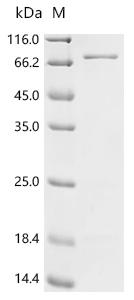 Recombinant Escherichia coli Cytoplasmic trehalase (treF) - image 1