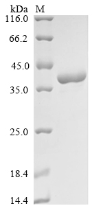(Tris-Glycine gel) Discontinuous SDS-PAGE (reduced) with 5% enrichment gel and 15% separation gel. (Tris-Glycine gel) Discontinuous SDS-PAGE (reduced) with 5% enrichment gel and 15% separation gel.