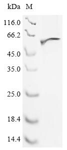 (Tris-Glycine gel) Discontinuous SDS-PAGE (reduced) with 5% enrichment gel and 15% separation gel. (Tris-Glycine gel) Discontinuous SDS-PAGE (reduced) with 5% enrichment gel and 15% separation gel.