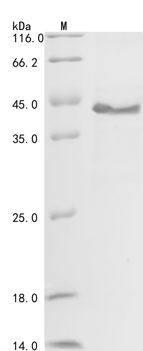 (Tris-Glycine gel) Discontinuous SDS-PAGE (reduced) with 5% enrichment gel and 15% separation gel. (Tris-Glycine gel) Discontinuous SDS-PAGE (reduced) with 5% enrichment gel and 15% separation gel.