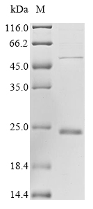 (Tris-Glycine gel) Discontinuous SDS-PAGE (reduced) with 5% enrichment gel and 15% separation gel. (Tris-Glycine gel) Discontinuous SDS-PAGE (reduced) with 5% enrichment gel and 15% separation gel.