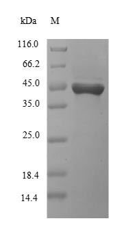 (Tris-Glycine gel) Discontinuous SDS-PAGE (reduced) with 5% enrichment gel and 15% separation gel. (Tris-Glycine gel) Discontinuous SDS-PAGE (reduced) with 5% enrichment gel and 15% separation gel.
