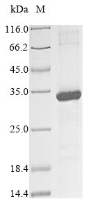 (Tris-Glycine gel) Discontinuous SDS-PAGE (reduced) with 5% enrichment gel and 15% separation gel. (Tris-Glycine gel) Discontinuous SDS-PAGE (reduced) with 5% enrichment gel and 15% separation gel.